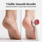 🦶 50% OFF NOW! Double-sided foot file for calluses—salon-quality results at home—removes calluses & leaves your feet baby-soft ✨🛁